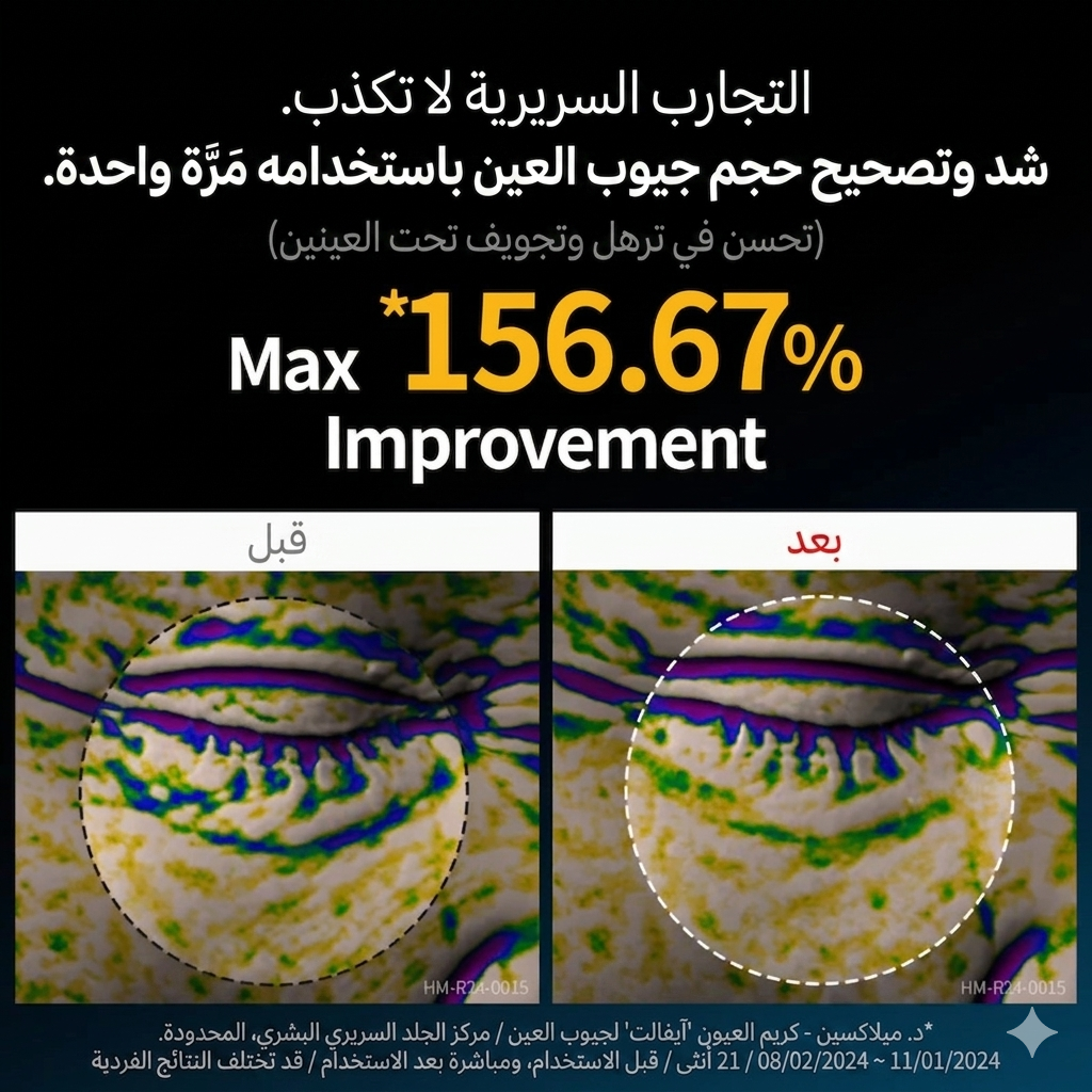 Dr. Melaxin Eyephalt كريم لعلاج انتفاخات العين